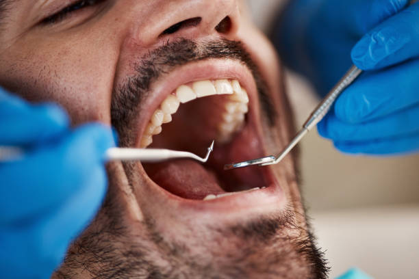 Oral Surgery in East Mountain, TX